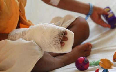 3 quemados con pólvora en la noche de velitas en Ibagué, van 23 en el año