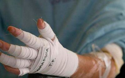 Tres quemados por pólvora se registraron en Ibagué la noche del 31