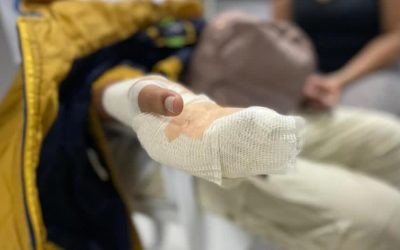 Primer quemado con pólvora en esta Navidad