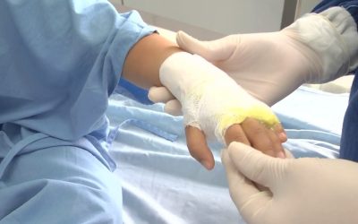 30 personas quemadas con pólvora durante diciembre