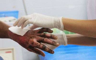 Se le estalló un volcán de pólvora