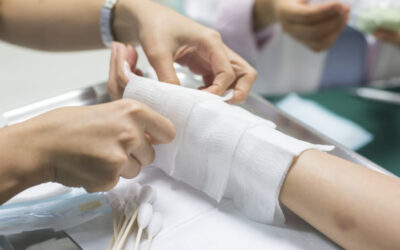 San Antonio registra nuevo lesionado por pólvora y alcohol