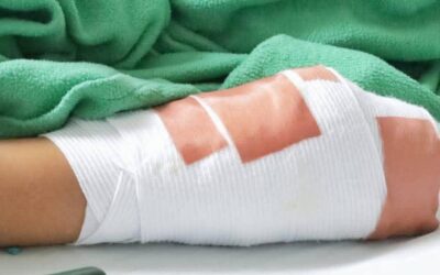 Tolima llega a 28 lesionados por pólvora