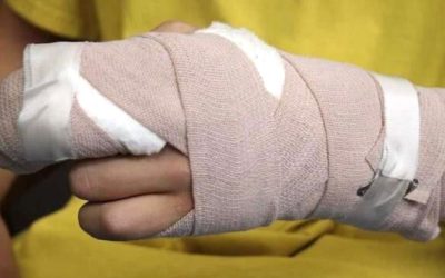 Dos quemados deja la Noche de Velitas en Ibagué