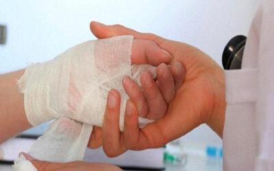 Tolima registra 18 quemados por pólvora antes de Nochebuena