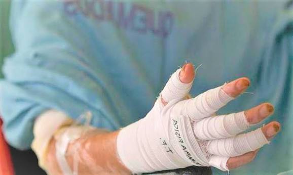 Tolima reporta 27 lesionados por pólvora y mantiene alerta sanitaria